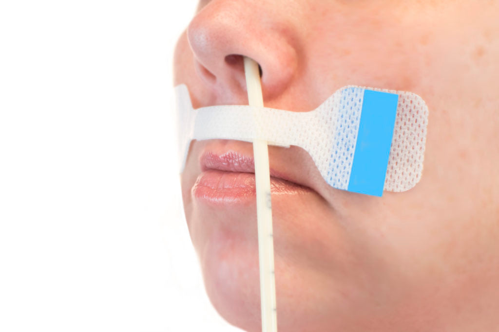 9304-1 - M.C. Johnson Securement Device, Nasogastric, Adhesive Base, Moisture Resistant Holder