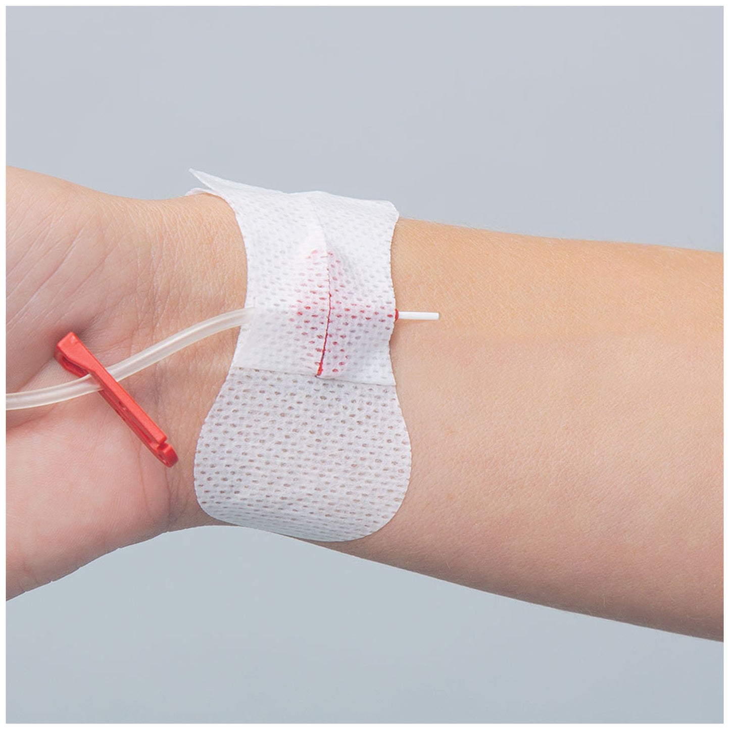 3300MIV - TIDI Grip-Lok® Arterial Catheter Securement Device - Universal Winged Arterial & Peripheral IV Catheter, Sterile, 100/bx