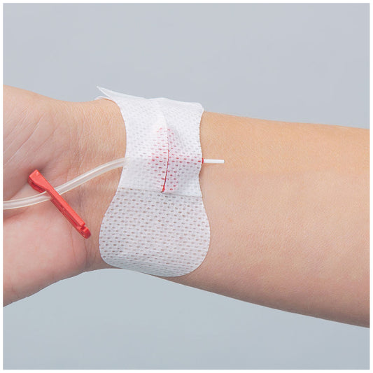 3300MIV - TIDI Grip-Lok® Arterial Catheter Securement Device - Universal Winged Arterial & Peripheral IV Catheter, Sterile, 100/bx
